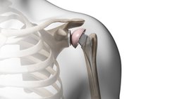 Dr. Thiago Tomazi, MSc. - Orthopäde 4910 Ried im Innkreis