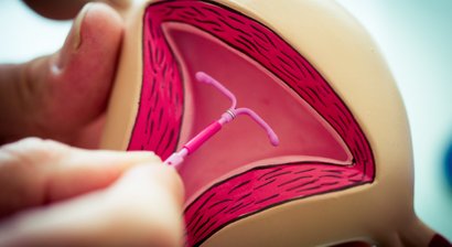 Moderne Empfängnisverhütung