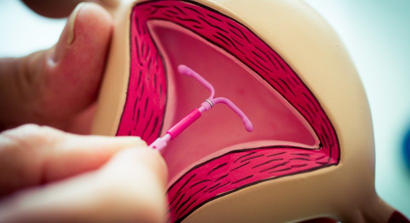 Moderne Empfängnisverhütung - Dr. Gerald Fischerlehner, MBA - Frauenarzt Linz 4020