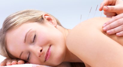Akupunktur
