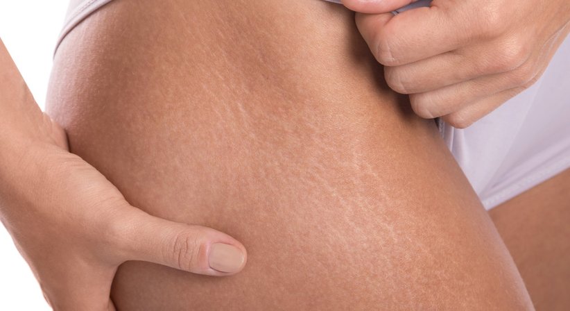 Straffungsoperationen - Dr. Rajmond Pikula - Plastischer Chirurg Götzis 6840