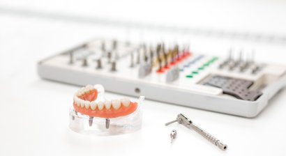 Zahnimplantate und 3D Röntgen