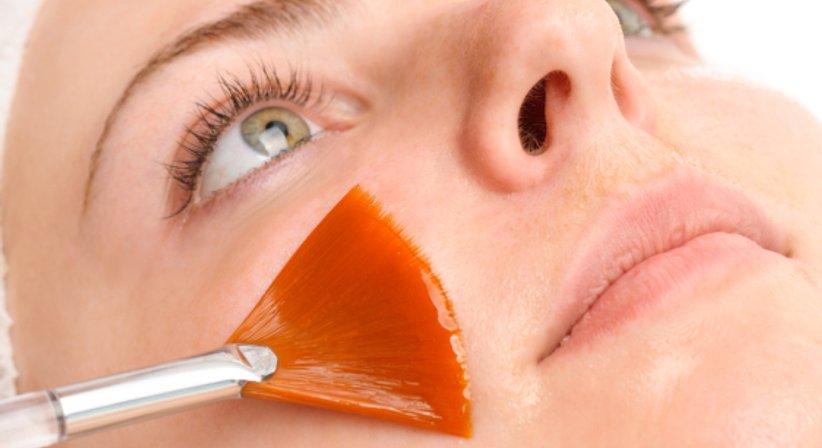 Medizinisches Peeling - Dr. Andrea Luidold - Praktische Ärztin Leibnitz 8430