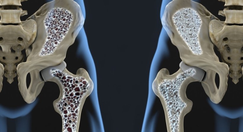 Hüftgelenksnahe Frakturversorgung - Prim. Dr. Wolfgang Kaltenbrunner - Orthopäde Korneuburg 2100