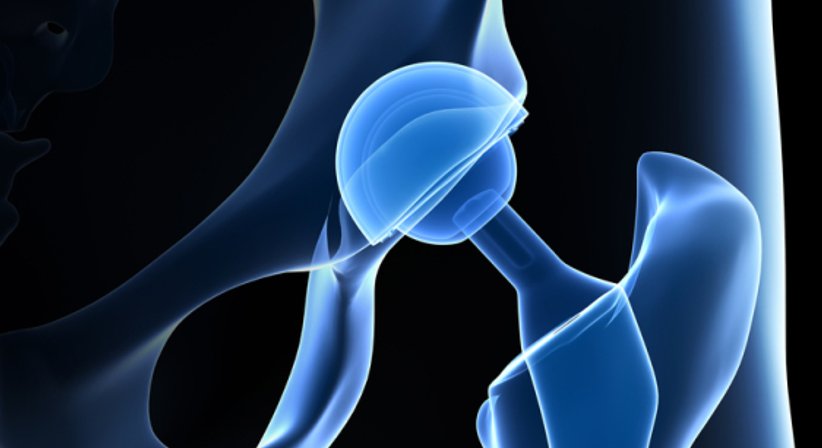 Prothetik - Prim. Dr. Wolfgang Kaltenbrunner - Orthopäde Korneuburg 2100