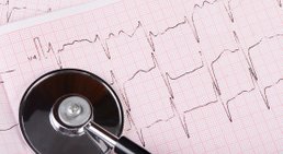 EKG -