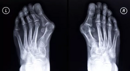 Dr. Omar El-Shohoumi - Orthopäde Stockerau 2000