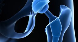 Dr. Omar El-Shohoumi - Orthopäde Stockerau 2000