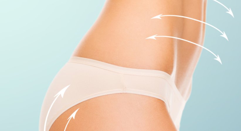 Fettabsaugung - Univ.-Doz. Dr. Franz Maria Haas - Plastischer Chirurg Graz 8047