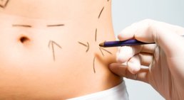 Univ.-Doz. Dr. Franz Maria Haas - Plastischer Chirurg Graz 8047