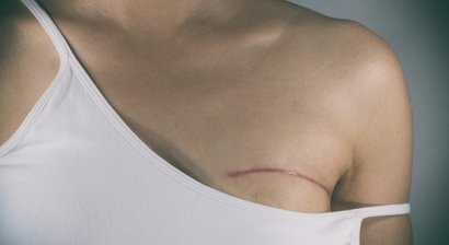 Wiederherstellungschirurgie