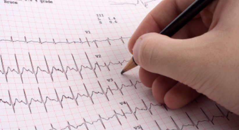 Herzrhythmusstörungen - Dr. med. univ. Sabine Scherzer - Internistin Wien 1090