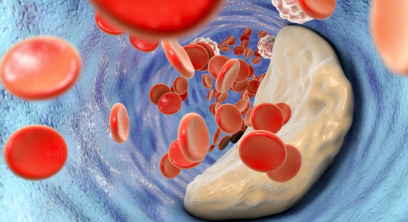 Koronare Herzerkrankung - Dr. med. univ. Sabine Scherzer - Internistin Wien 1090