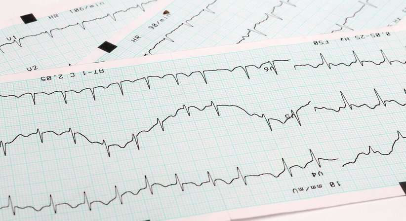 Event Recorder - OA Dr. Marcel Francesconi - Kardiologe Wien 1030