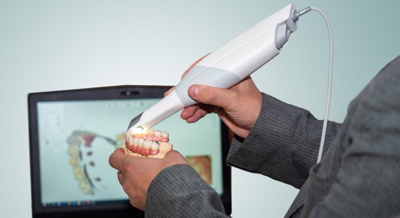 Intraoralscanner (digitale Abformung) - Dr. Sherwin Moayedifar - Zahnarzt Wien 1140