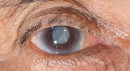 Dr. Andreas Grechenig - Augenarzt Wien 1230