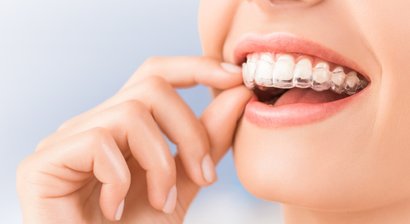 Schienentherapie mit unsichtbaren Alignen