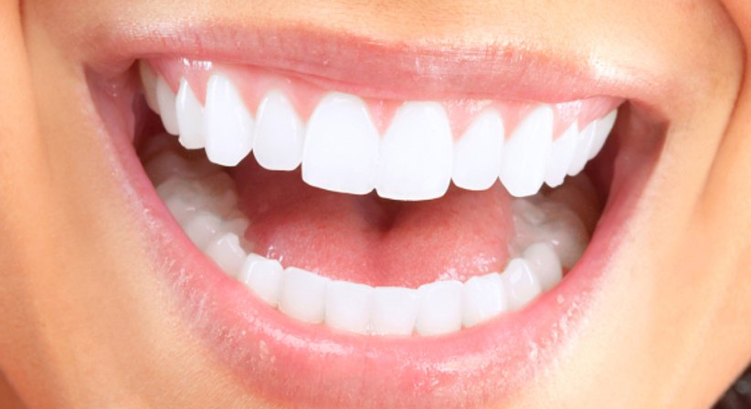 Weiße Füllungen aus Composite - Dr. med. dent. Ursula Hersch - Zahnärztin Wien 1030