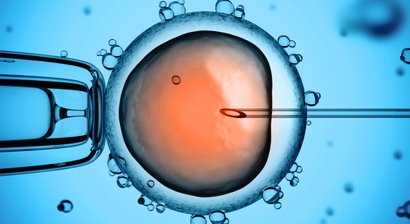 Künstliche Befruchtung