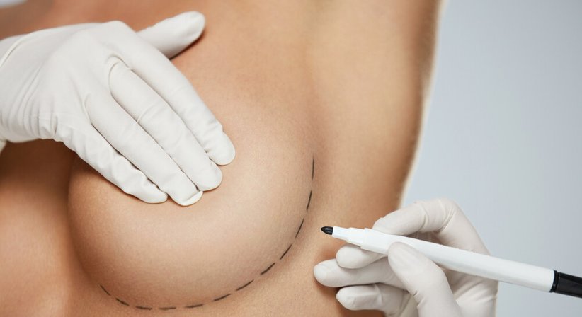 Brustchirurgie - Dr. Daniela Rieder - Plastische Chirurgin Wien 1010