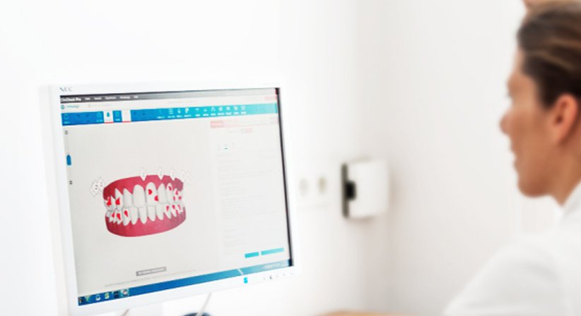 Invisalign - DDr. Kristina Hadwig - Zahnärztin Wien 1090