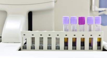 Konservative Knorpeltherapie