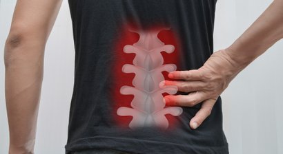 Osteochondrose (Bandscheibenverschleiß)