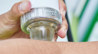 Kombinierte Stoßwellentherapie (ESWT)