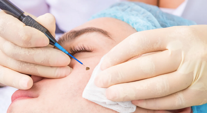 Operative Dermatologie