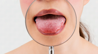 Schleimhauterkrankungen