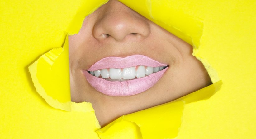 Bleaching - Dr. Stefanie Müllner-Salzl - Zahnärztin Wien 1030