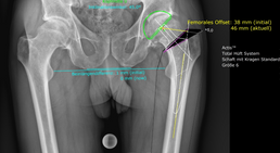 OA Dr. med. univ. Markus Wipperich - Orthopäde Wien 1130