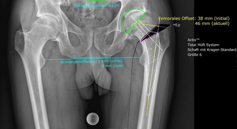Hüfte - OA Dr. med. univ. Markus Wipperich - Orthopäde Wien 1130