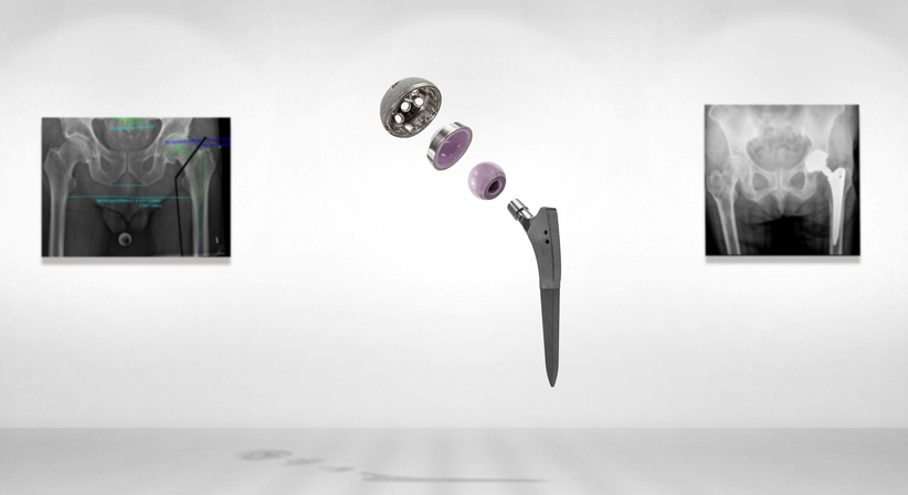 Hüfte - OA Dr. med. univ. Markus Wipperich - Orthopäde Wien 1130