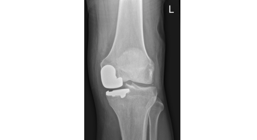 Knie - OA Dr. med. univ. Markus Wipperich - Orthopäde Wien 1130