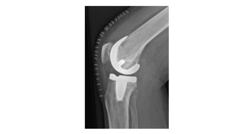 Knie - OA Dr. med. univ. Markus Wipperich - Orthopäde Wien 1130