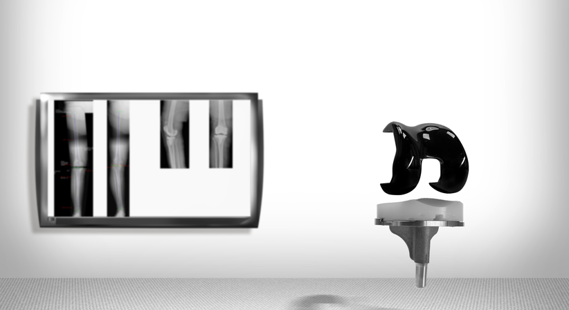 Knie - OA Dr. med. univ. Markus Wipperich - Orthopäde Wien 1130