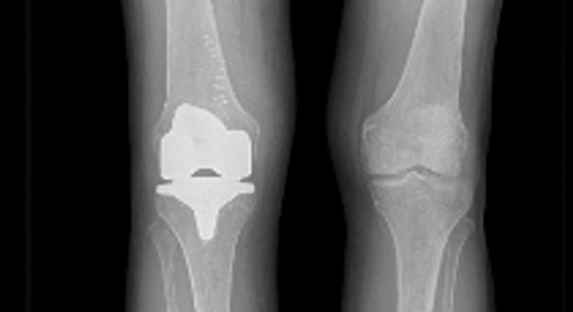 Knie - OA Dr. med. univ. Markus Wipperich - Orthopäde Wien 1130