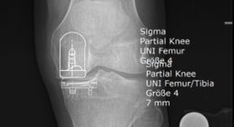 OA Dr. med. univ. Markus Wipperich - Orthopäde Wien 1130