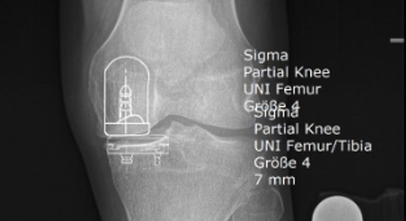 Knie - OA Dr. med. univ. Markus Wipperich - Orthopäde Wien 1130