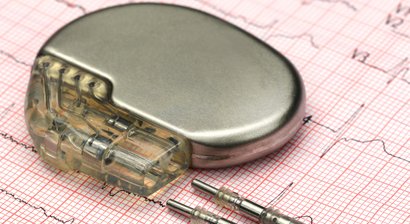 Herzschrittmacher – Beratung & Implantation
