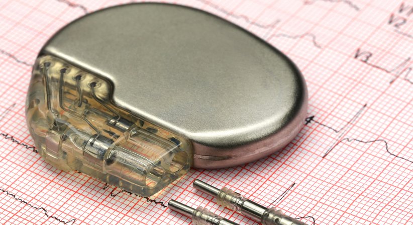 Herzschrittmacher – Beratung & Implantation bei Dr. Andras Döme Dezsi, PhD