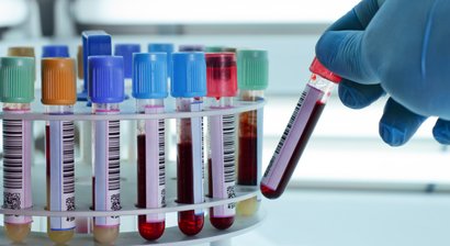 Vorsorgeuntersuchung