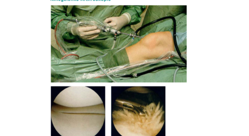 Arthrose - Dr. Hermann Leidolf - Unfallchirurg Wien 1010