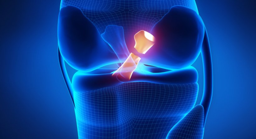 Kreuzband - OA Dr. Philip Zeller - Orthopäde Baden 2500