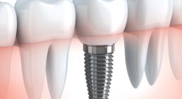 Dr. Andreas Quidenus, MSc - Zahnarzt Wien 1010