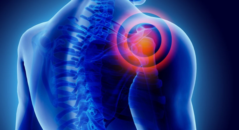 Schulterarthrose / künstliches Schultergelenk - Dr. Ulrich Lanz, IOC Dip Sp Phy - Orthopäde Wien 1130