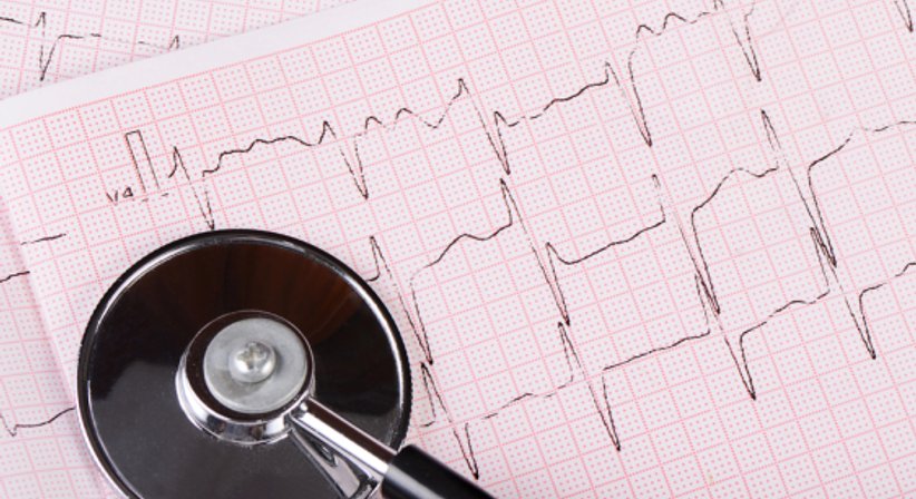 Ruhe-EKG - Dr. med.-univ. Birgit Höller - Praktische Ärztin Wien 1020
