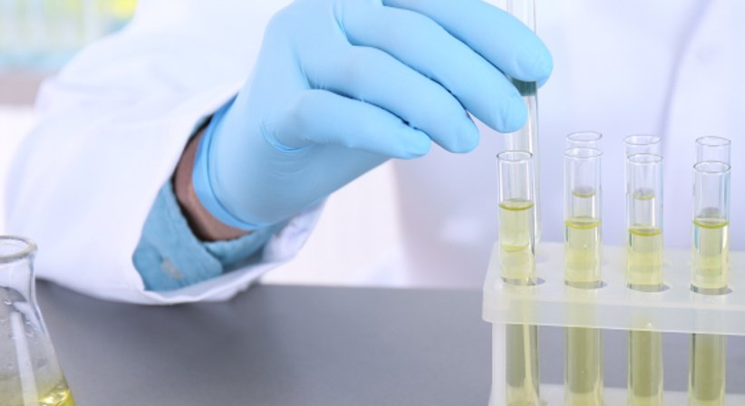 Männerspezifische Vorsorgeprogramme (AndroCHECK) - Priv.Doz. Dr. Markus Margreiter, FEBU, FECSM - Urologe Wien 1080