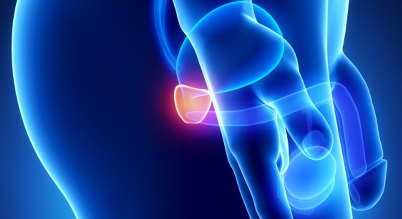 Prostataerkrankungen - Priv.Doz. Dr. Markus Margreiter, FEBU, FECSM - Urologe Wien 1080